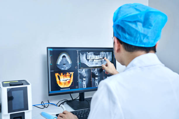 Best Knocked-Out Tooth (Avulsed Tooth) Treatment in Parsons, TN